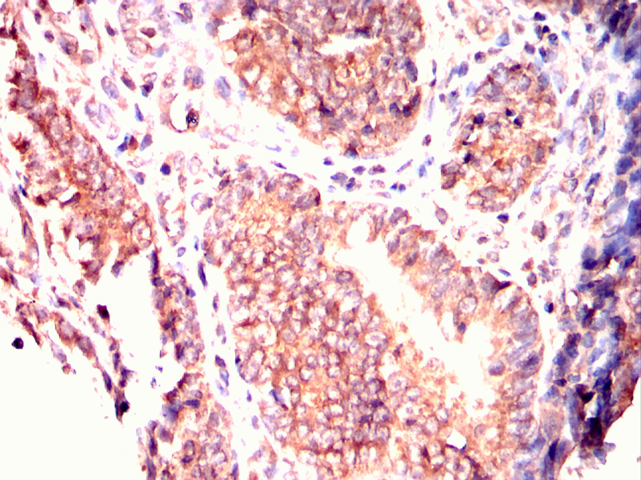 		IHC
